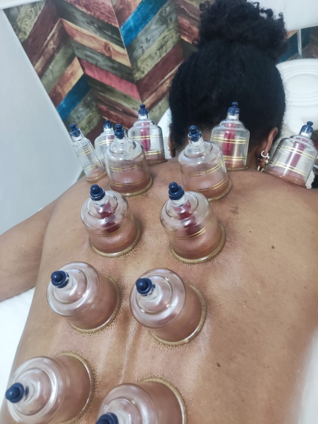S M Beauty Bloom #zadar Opća masaža Cupping masaža