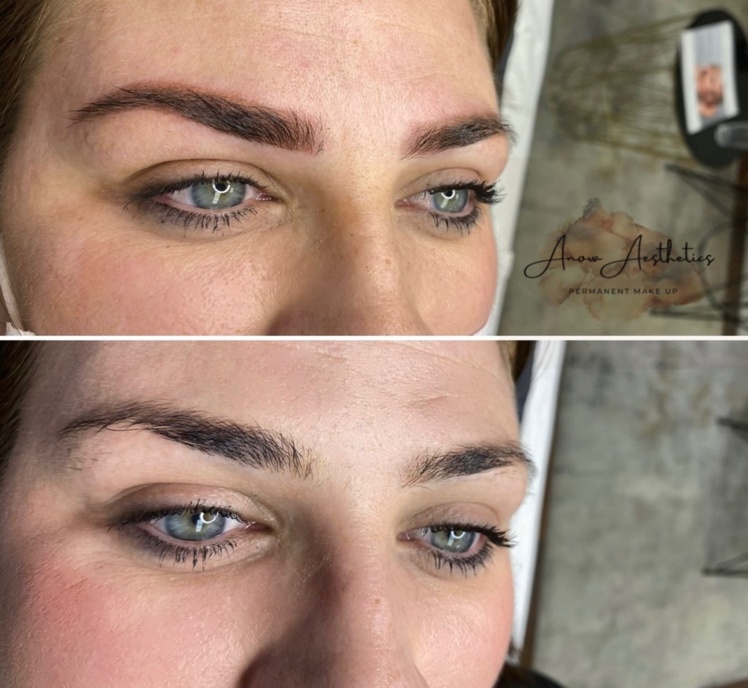 Anova Aesthetics #zagreb Trajna šminka Puder obrve