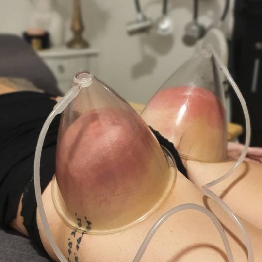 SOLO Beauty Centar usluga