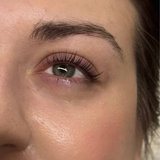 MOELL beauty #zagreb Trepavice Lash lift + bojanje + 3D filler Laminacija trepavica