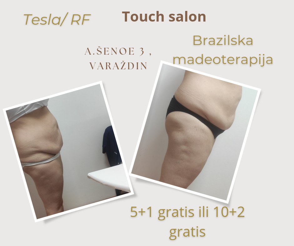 Touch #varazdin Anticelulit Mjesečni paket oblikovanja tijela 8 dolazaka - 60 minuta