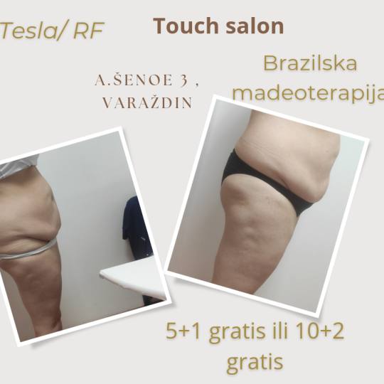 Touch #varazdin Anticelulit Mjesečni paket oblikovanja tijela 8 dolazaka - 60 minuta Aparat je  kor