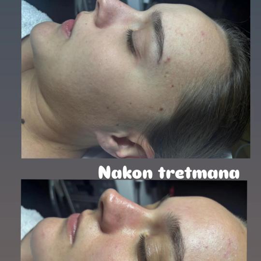 Valena estetica usluga