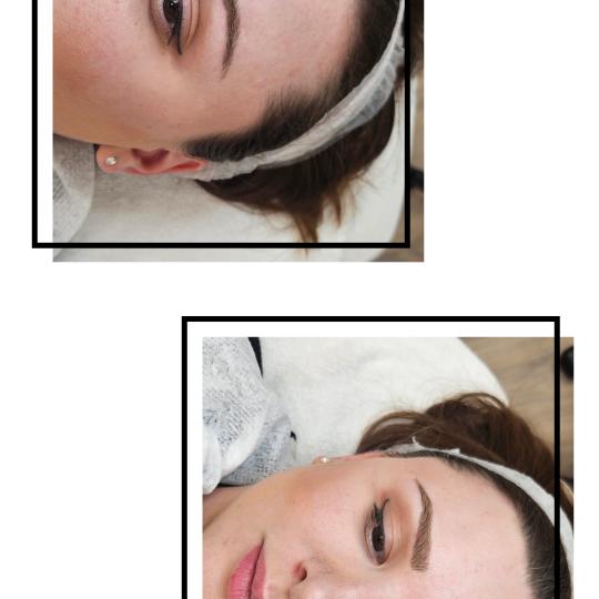 Cosmoderm & Centar Estetica usluga