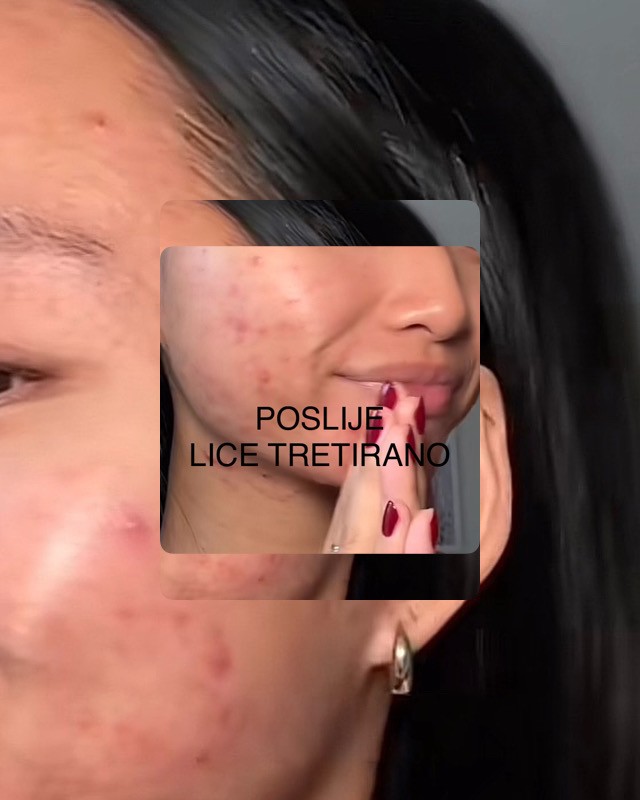 Head Spa #pula Tretman lica Kozmetička njega lica