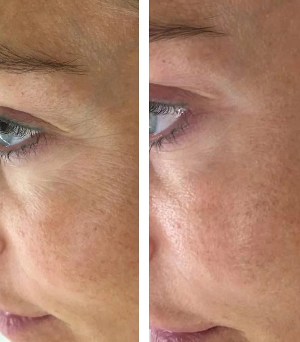 Aromavita Bella Donna #varazdin Tretman lica Opsis tretman