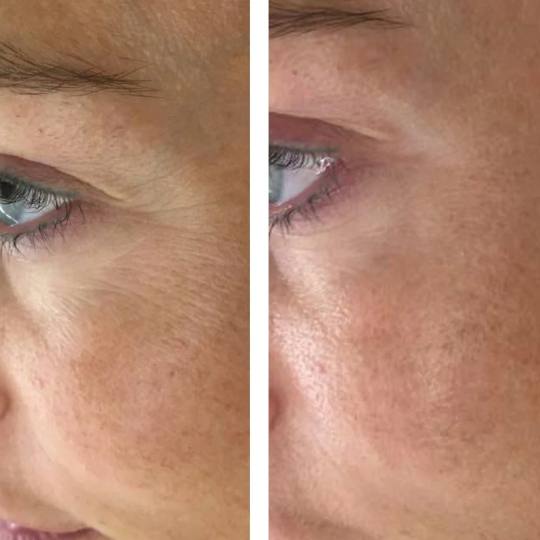 Aromavita Bella Donna usluga