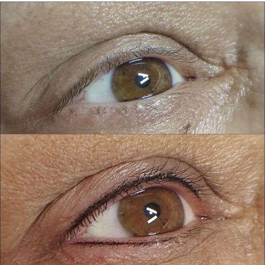 Contour usluga