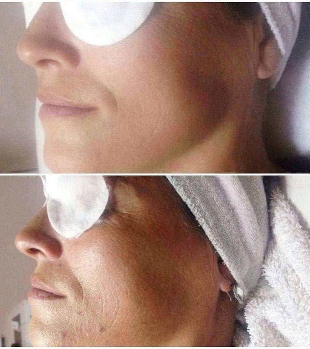 Kemijski piling - Antiage beauty room Lady Goga, Zagreb Tretman lica Lice Tretman lica, Zagreb, Novi Zagreb – zapad