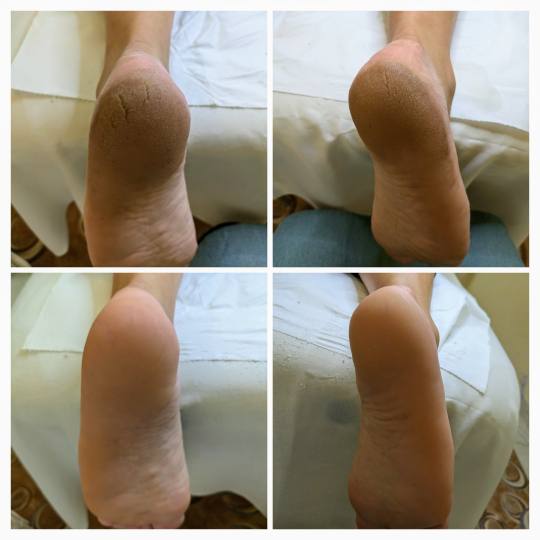 Gelaxy x Motus #zagreb Estetska pedikura Suha ruska pedikura + callux tretman