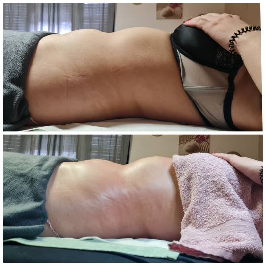 Glitter and glam #zagreb Tretmani tijela Limfno modelovanje - cijelo tijelo