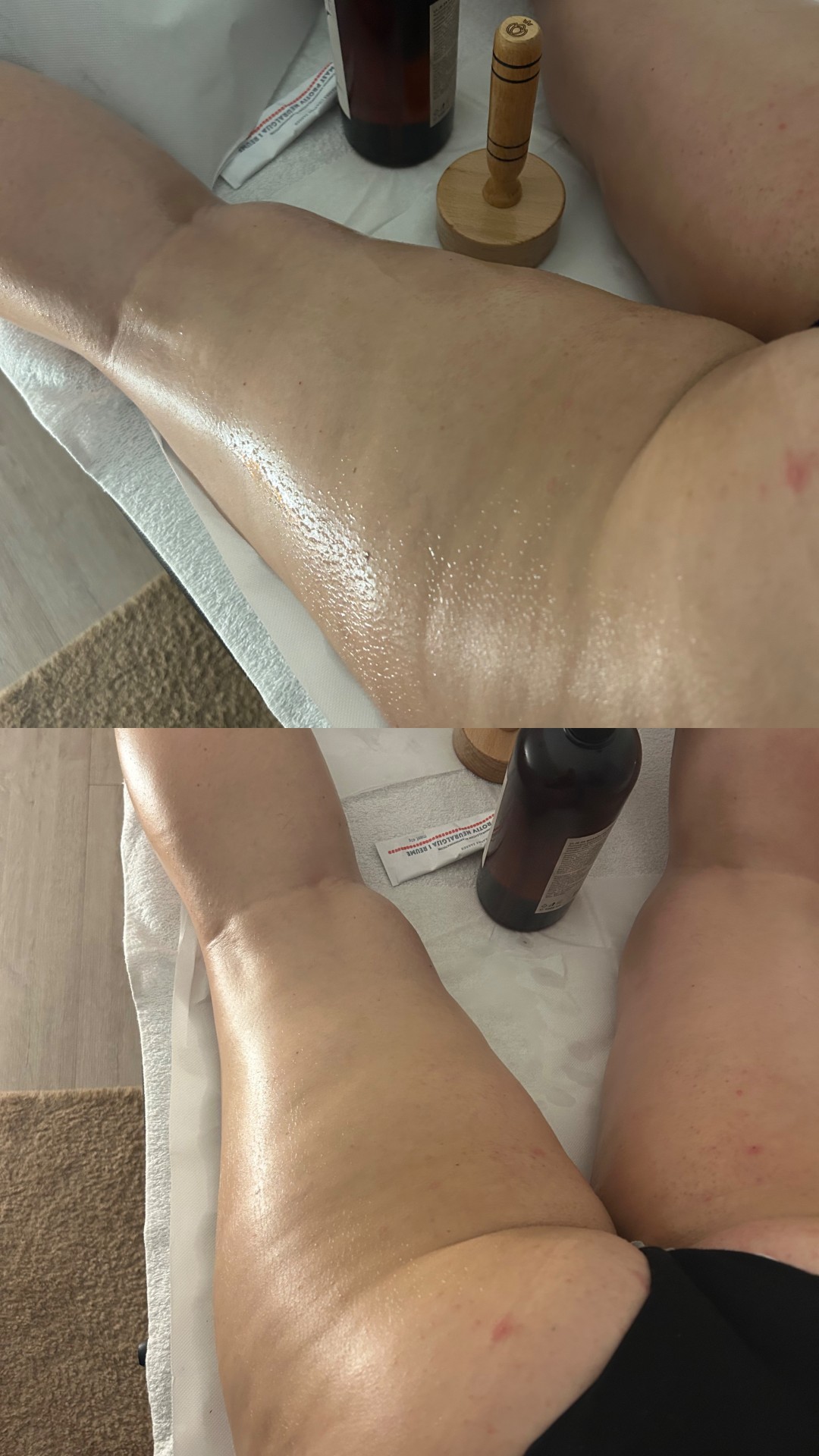 Fizio for You #zagreb Anticelulit masaža Brazilska maderoterapija