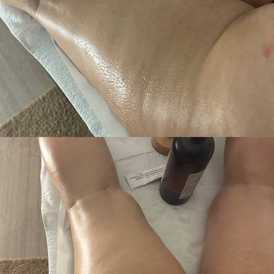 Fizio for You #zagreb Anticelulit masaža Brazilska maderoterapija Gornja slika je prije početka dr