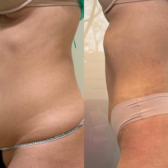 Perfect body beauty bar usluga