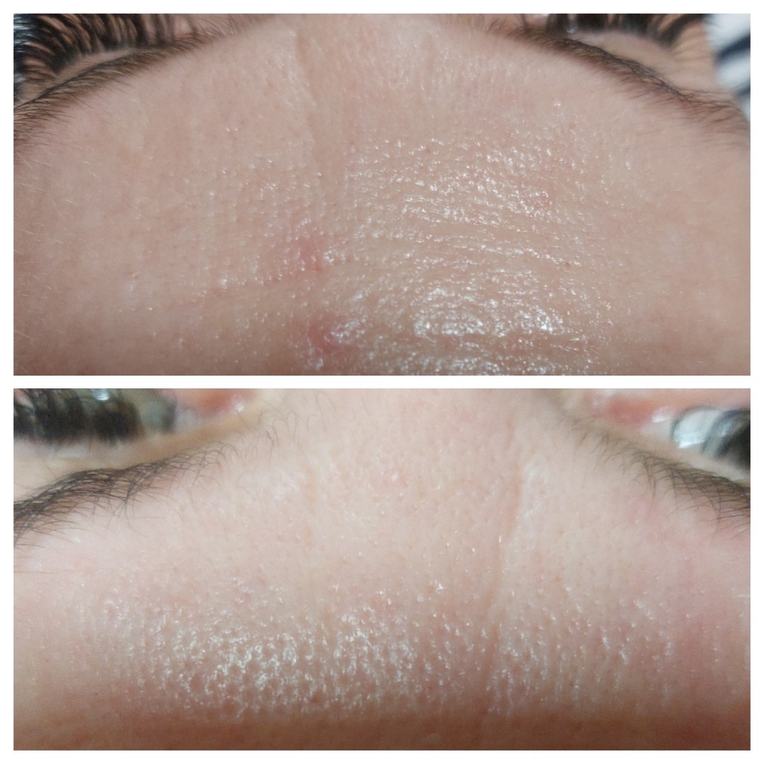 Antiage beauty room Lady Goga #zagreb Tretman lica