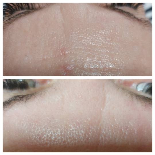 Antiage beauty room Lady Goga #zagreb Tretman lica