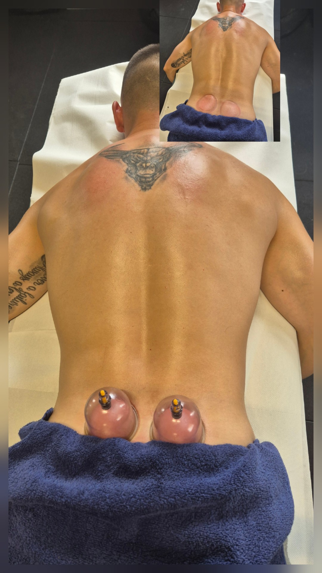 Reborn Glow By M #zagreb Opća masaža Cupping terapija - leđa