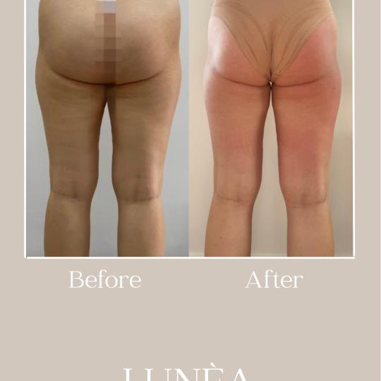 Lunea beauty usluga