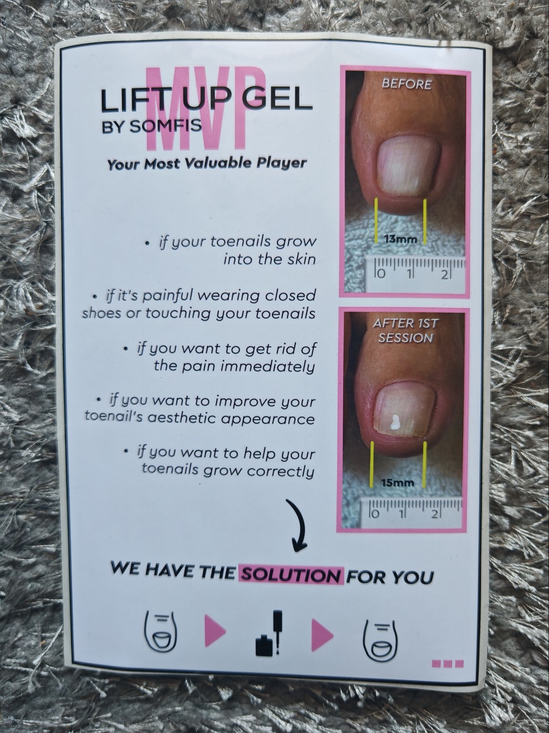 Kontesa Nera #zagreb Gel lak Lift Up gel terapija uraslog nokta + njega stopala