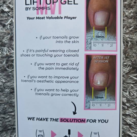 Kontesa Nera #zagreb Gel lak Lift Up gel terapija uraslog nokta + njega stopala Revolucionarna bezbo