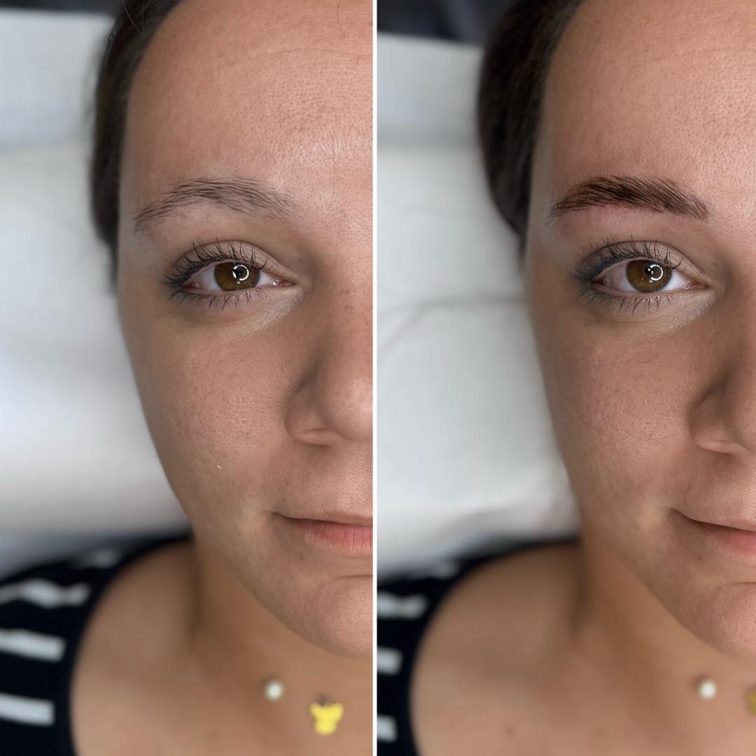 Anova Aesthetics #zagreb Obrve Brow lift + bojanje + oblikovanje obrva