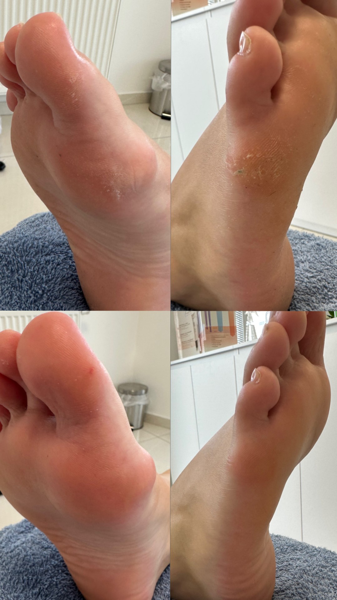 Beauty Centar Sky #zagreb Estetska pedikura Ruska pedikura