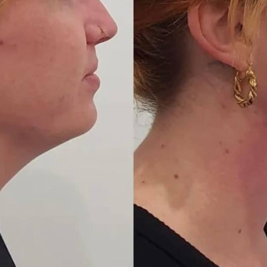 Estetix centar usluga