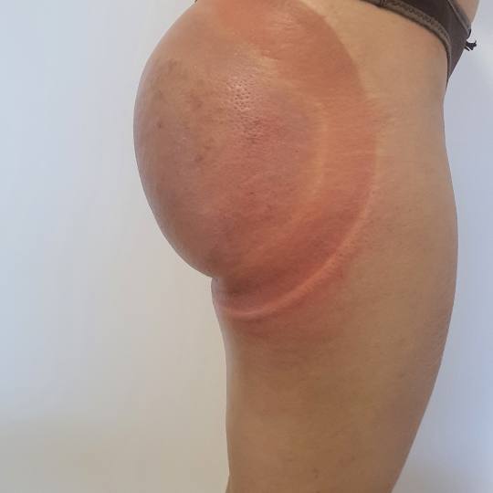 SOLO Beauty Centar usluga