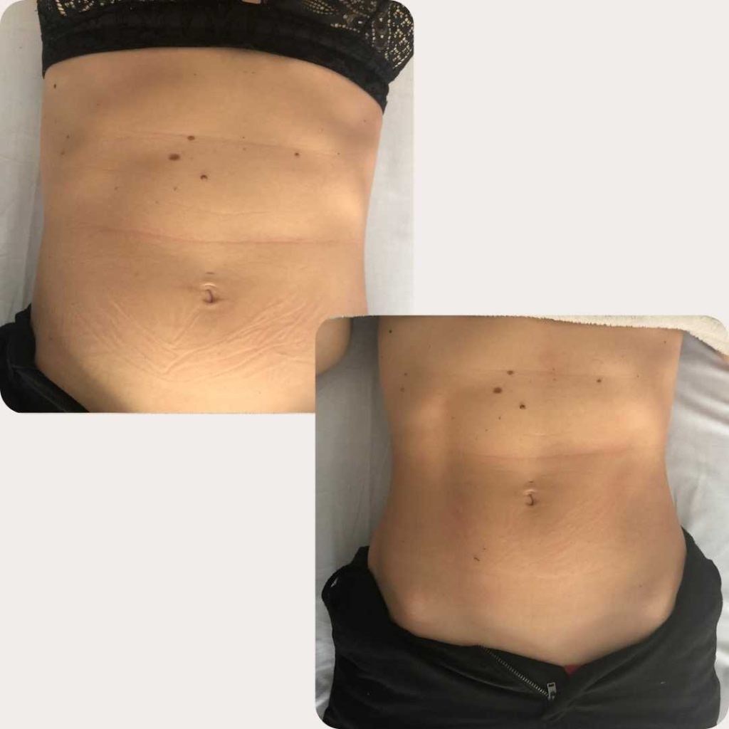 Latissimus, Zagreb LookBook