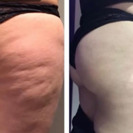 Perfect body beauty bar usluga