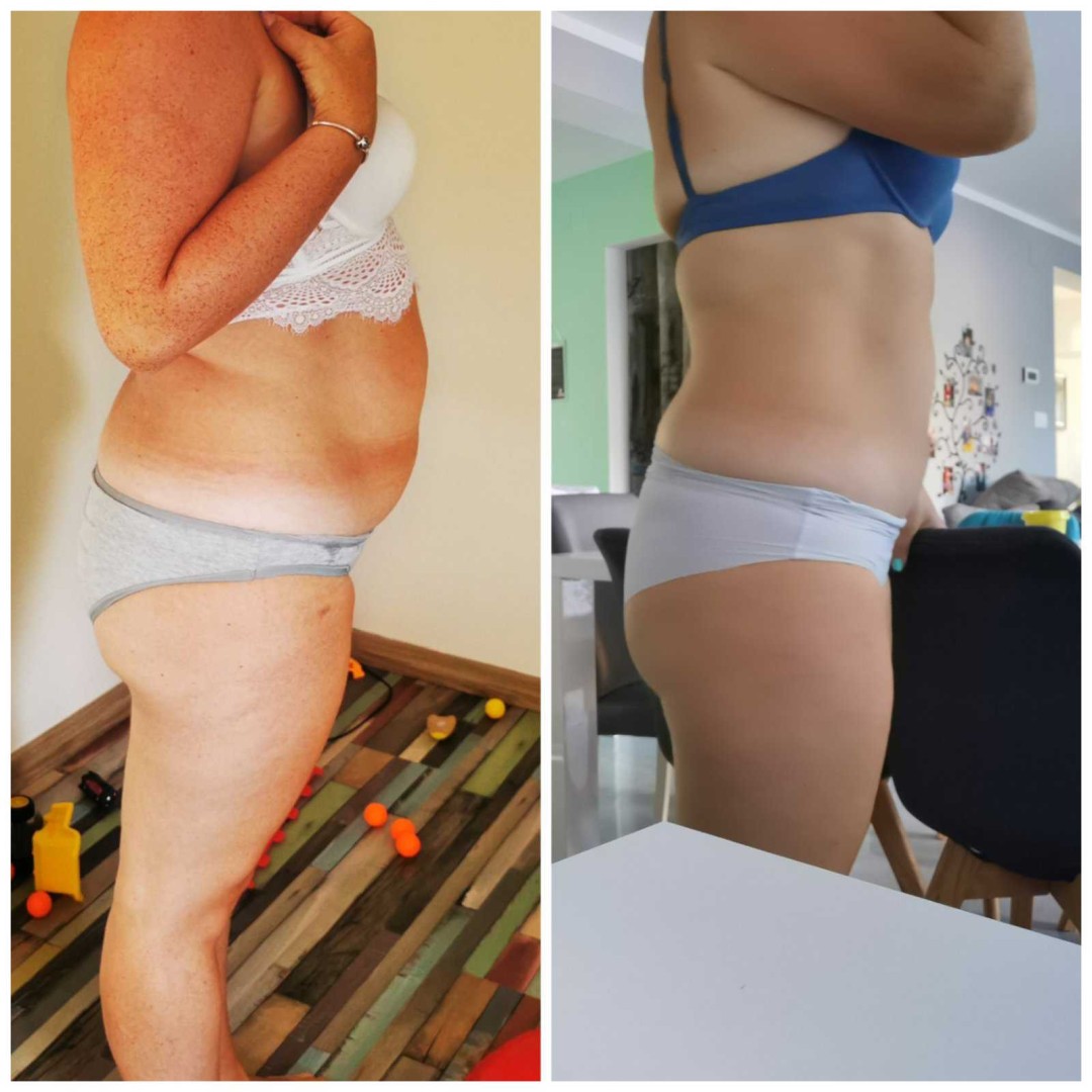 Natural #rijeka Tretmani tijela CRYO tretman - 1 sonda