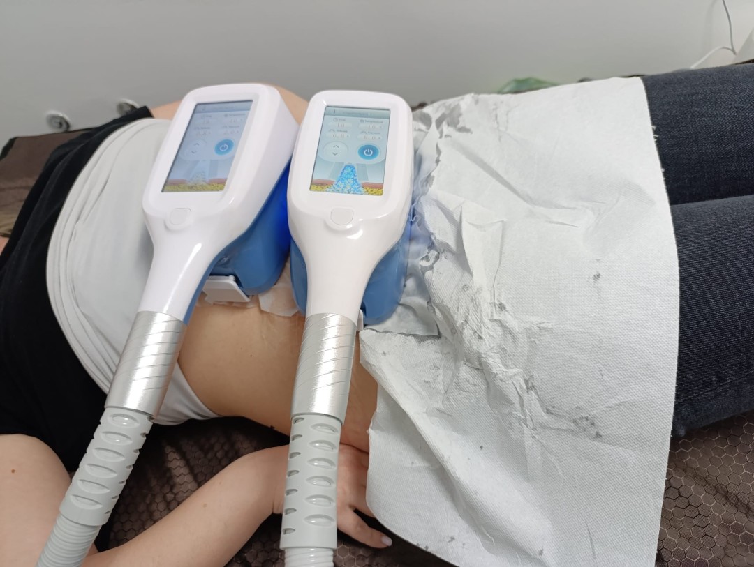 Timeless by Sanja #zagreb Tretmani tijela Coolsclupting kriolipoliza