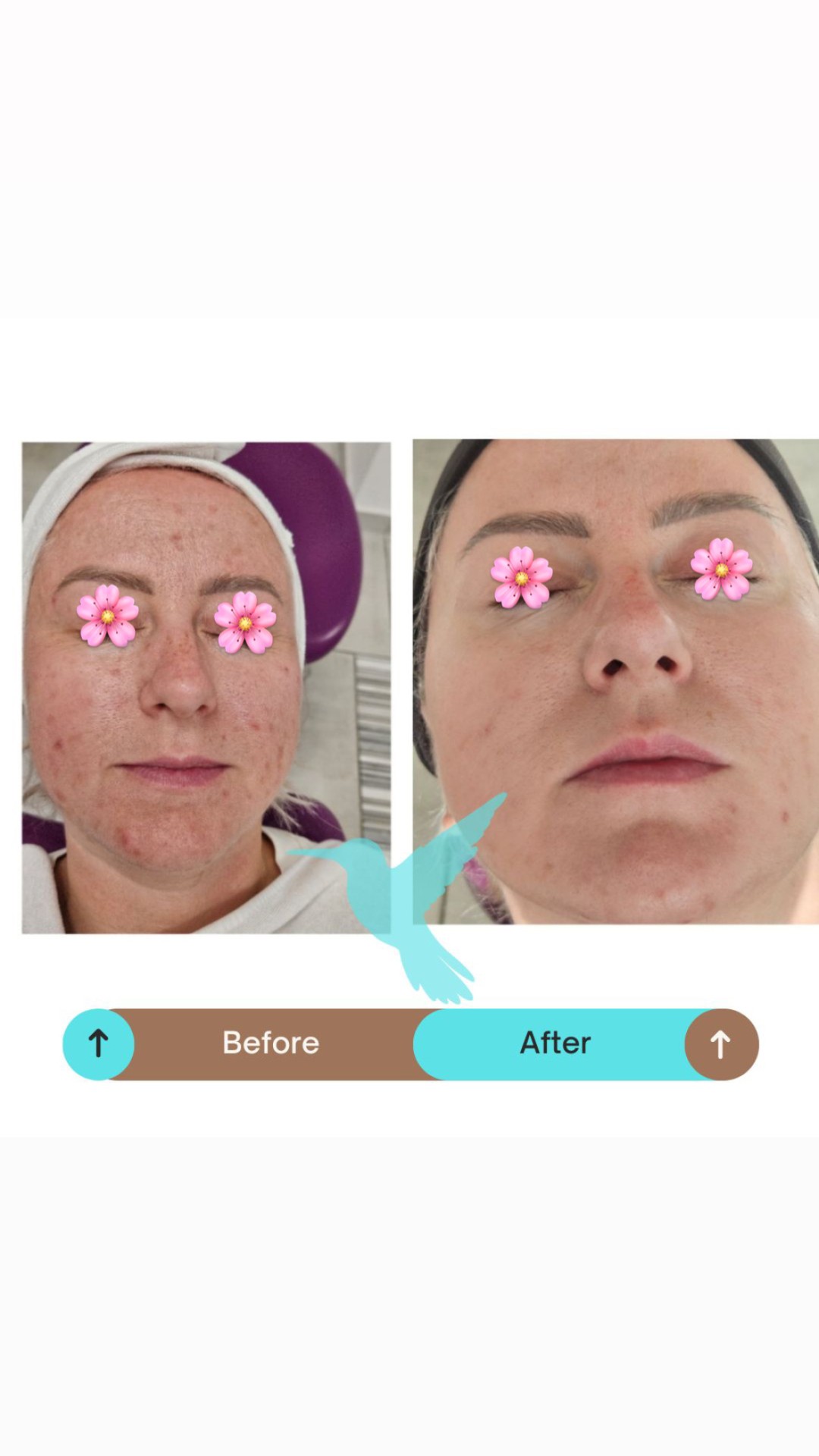 Luma Medic #zagreb Tretman lica SQT revitalizing