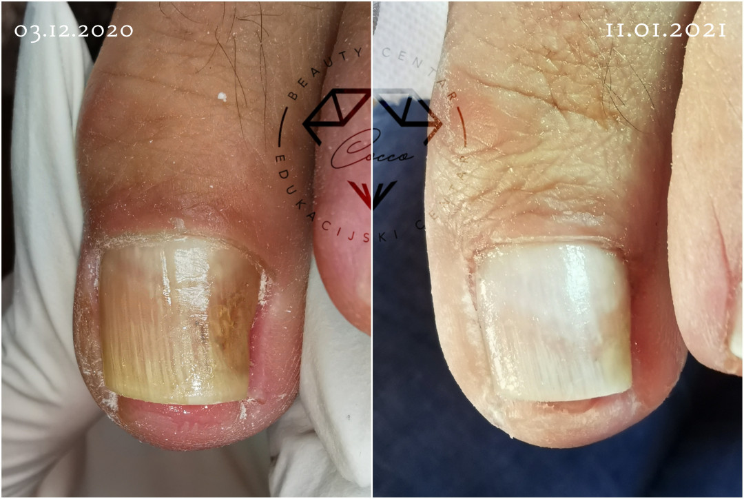 Beauty Centar By Cocco #viskovo Estetska pedikura