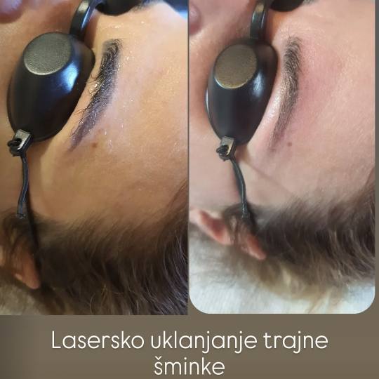 SOLO Beauty Centar usluga