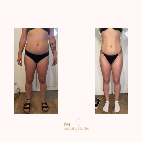 I'M beauty studio #zagreb Anticelulit Promo paket - 10x brazilska maderoterapija (noge gluteus 