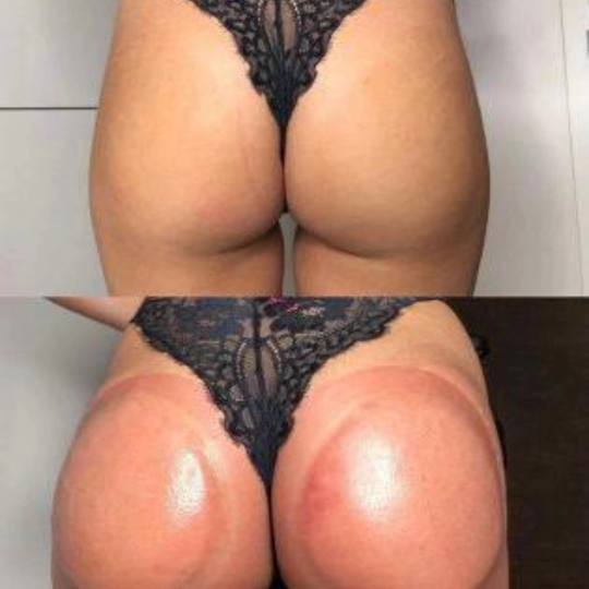 Antiage beauty room Lady Goga usluga