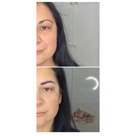 Anova Aesthetics usluga