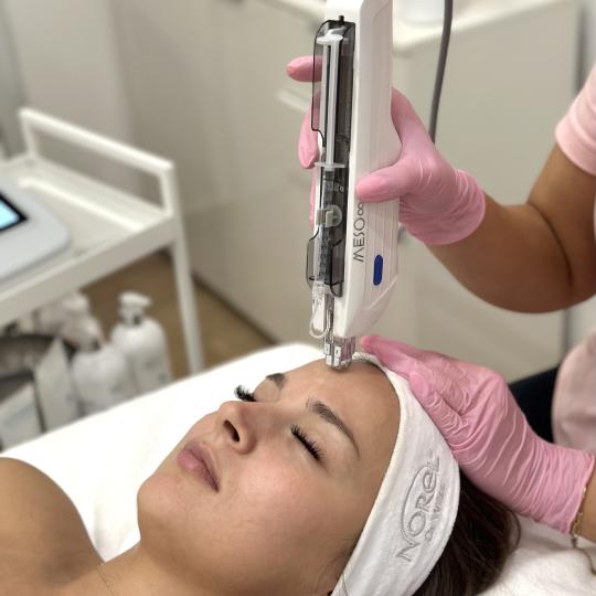 Beauty Box - Zagreb #zagreb Tretman lica Mezoterapija lica - Meso chip skin reset