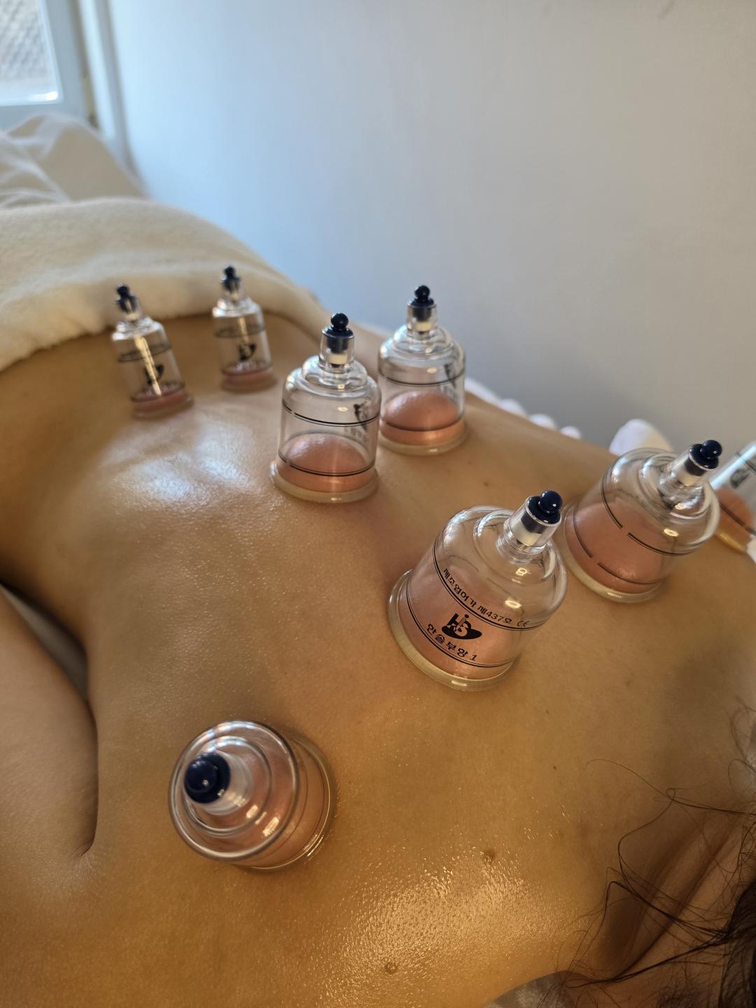 Impuls #kastav Masaža cijelog tijela Cupping vakuum masaža - 50 minuta