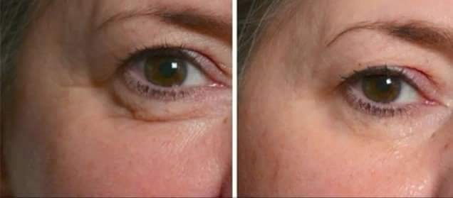 Antiage beauty room Lady Goga #zagreb Tretman lica