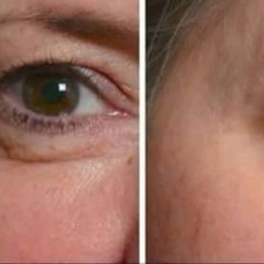 Antiage beauty room Lady Goga #zagreb Tretman lica