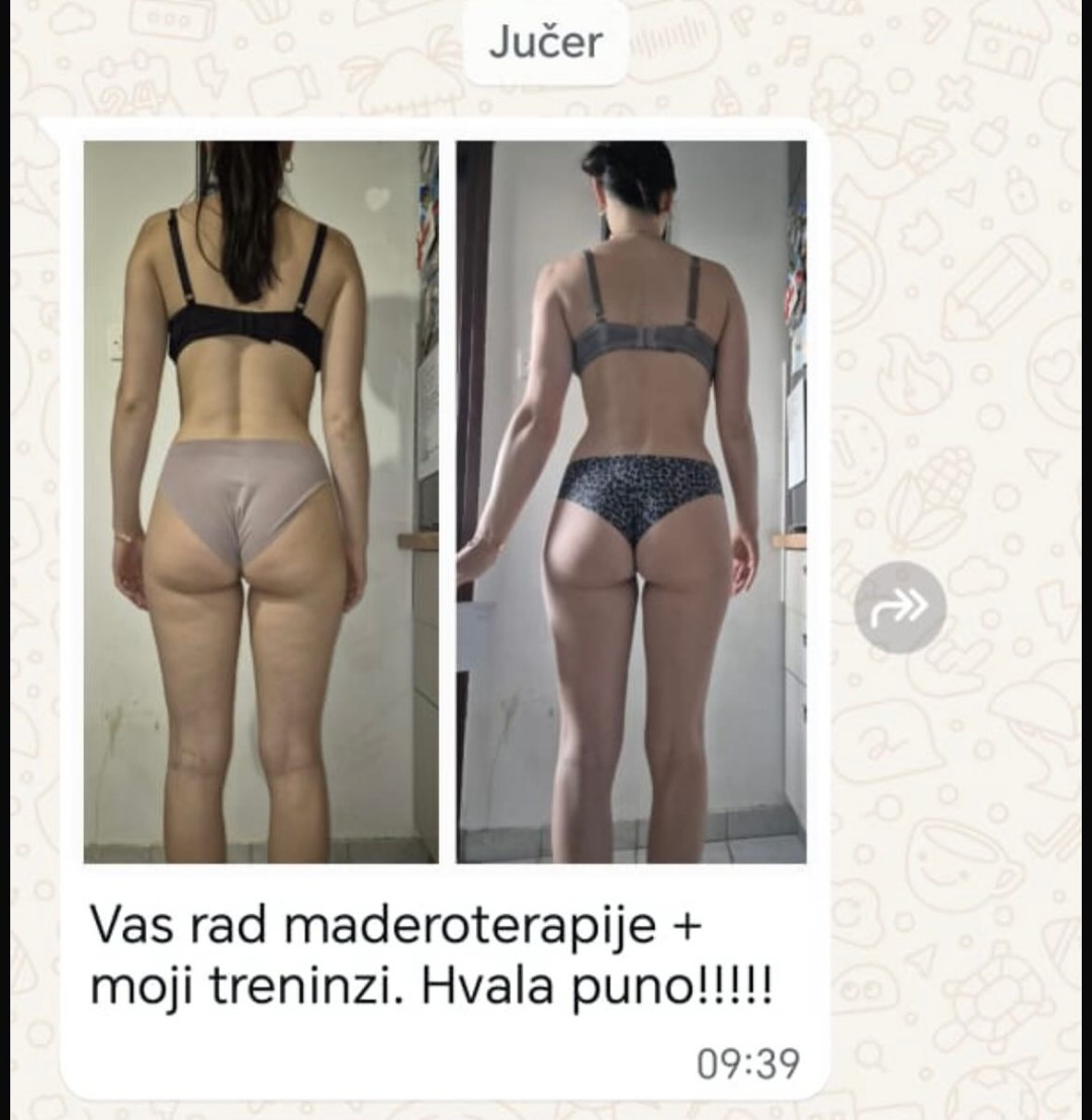 Nirvana Life Therapy #zagreb Tretmani za mršavljenje Brazilska maderoterapija 30 min