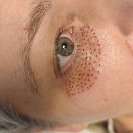 BioLaser Studio Rijeka usluga