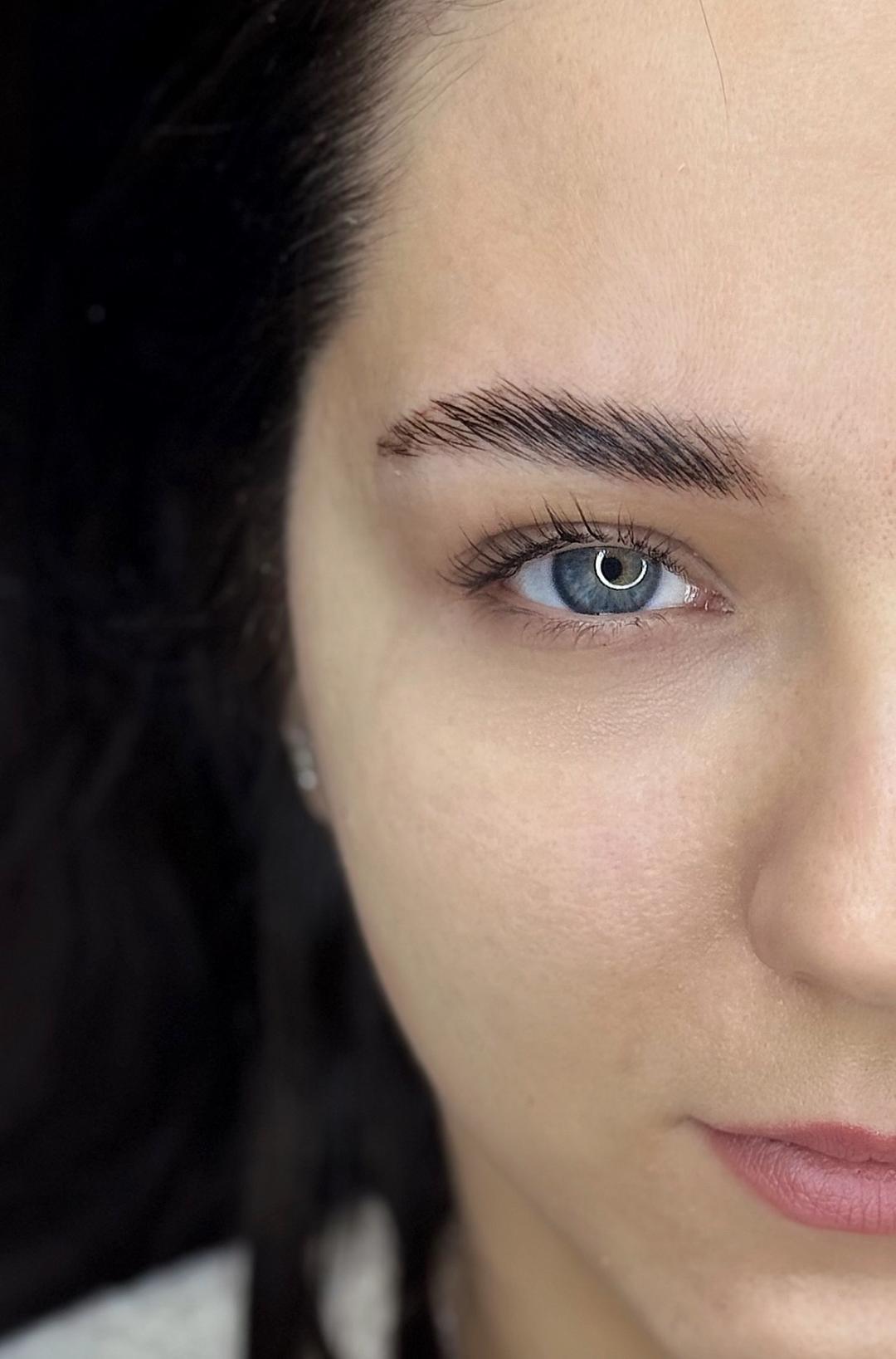 Anova Aesthetics #zagreb Obrve Brow lift