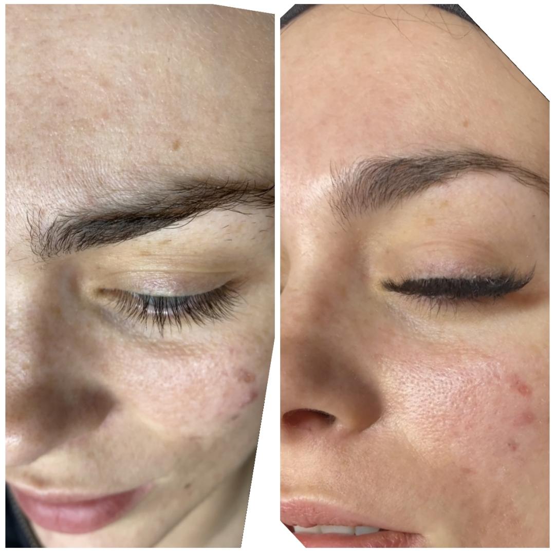 Nefertiti Studio #zagreb Tretman lica Hydrafacial Deluxe tretman lica