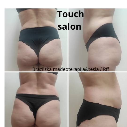 Touch #varazdin Anticelulit masaža Brazilska maderoterapija - cijelo tijelo Za razliku od klasične