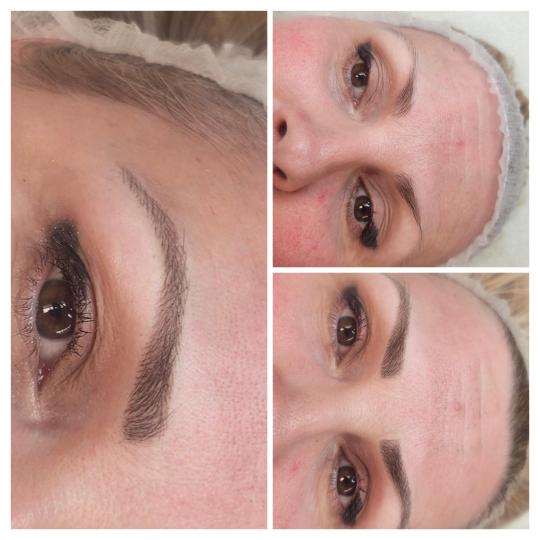 Cosmoderm & Centar Estetica usluga