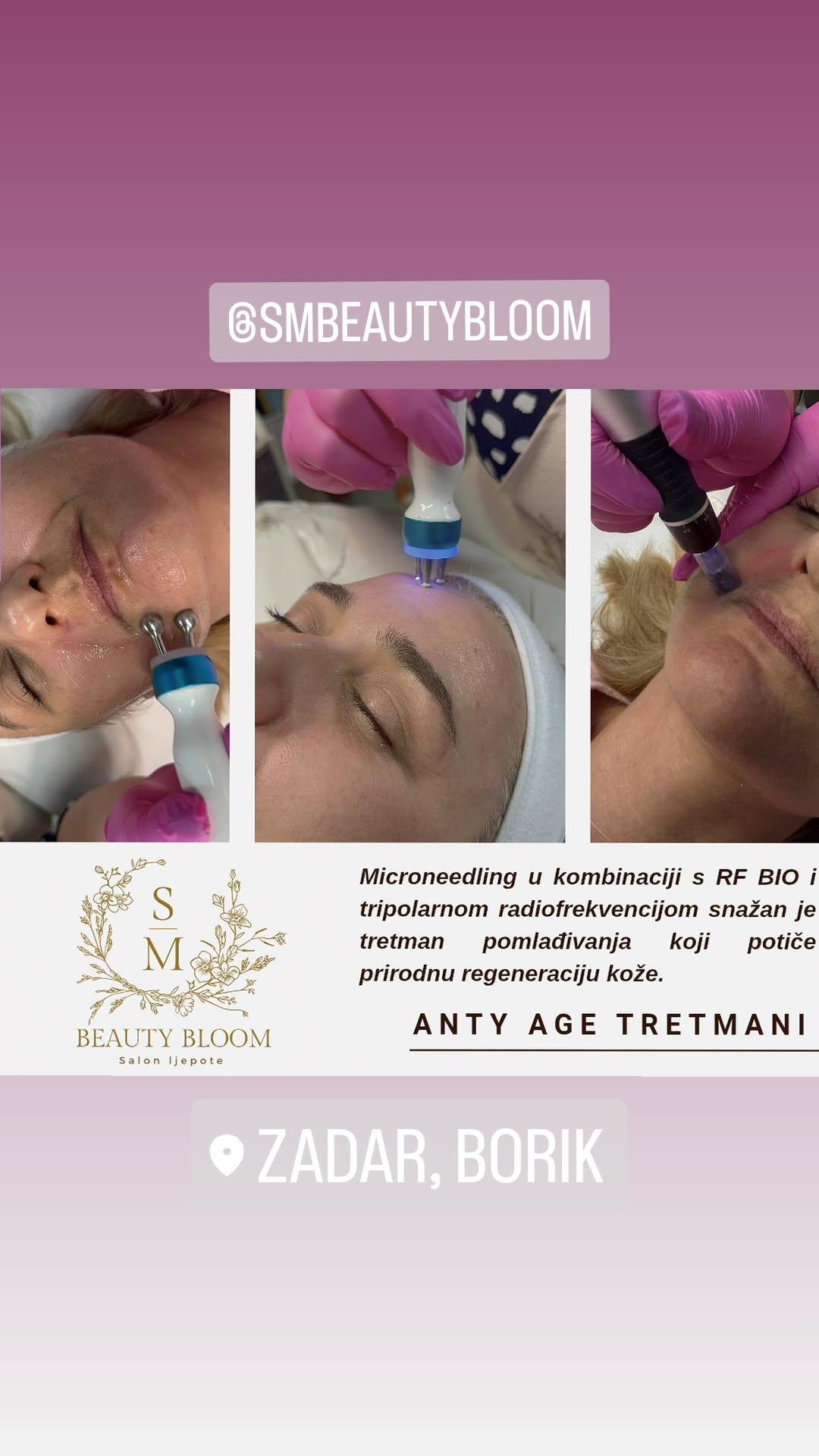 S M Beauty Bloom #zadar Hijaluronski tretmani lica Hydrafacial phenix - anty age tretman lica