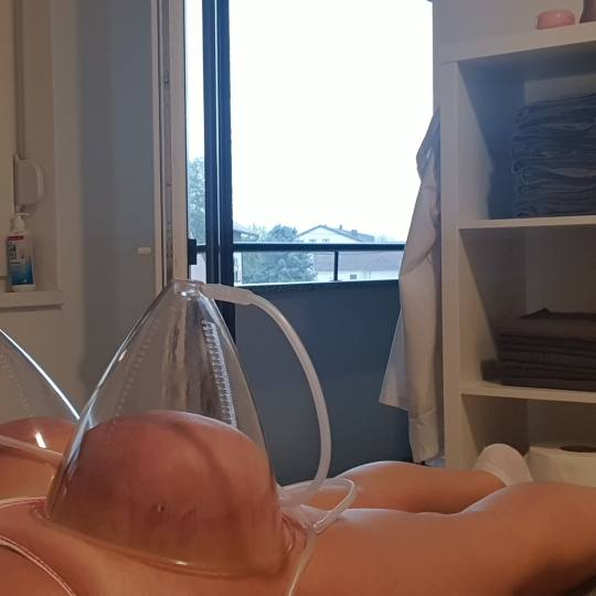 SOLO Beauty Centar #zagreb Tretmani tijela Butt lift vacuum Vakumska terapija podizanja stražnjice 